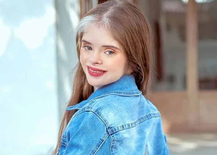 Jessica A Model With Down Syndrome Is Shattering Beauty Standards And Paving The Way For